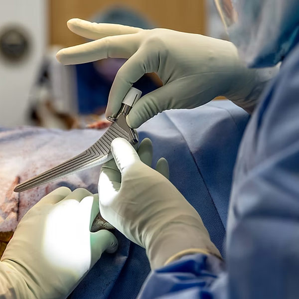 Hip Replacement Surgery in Ahmedabad