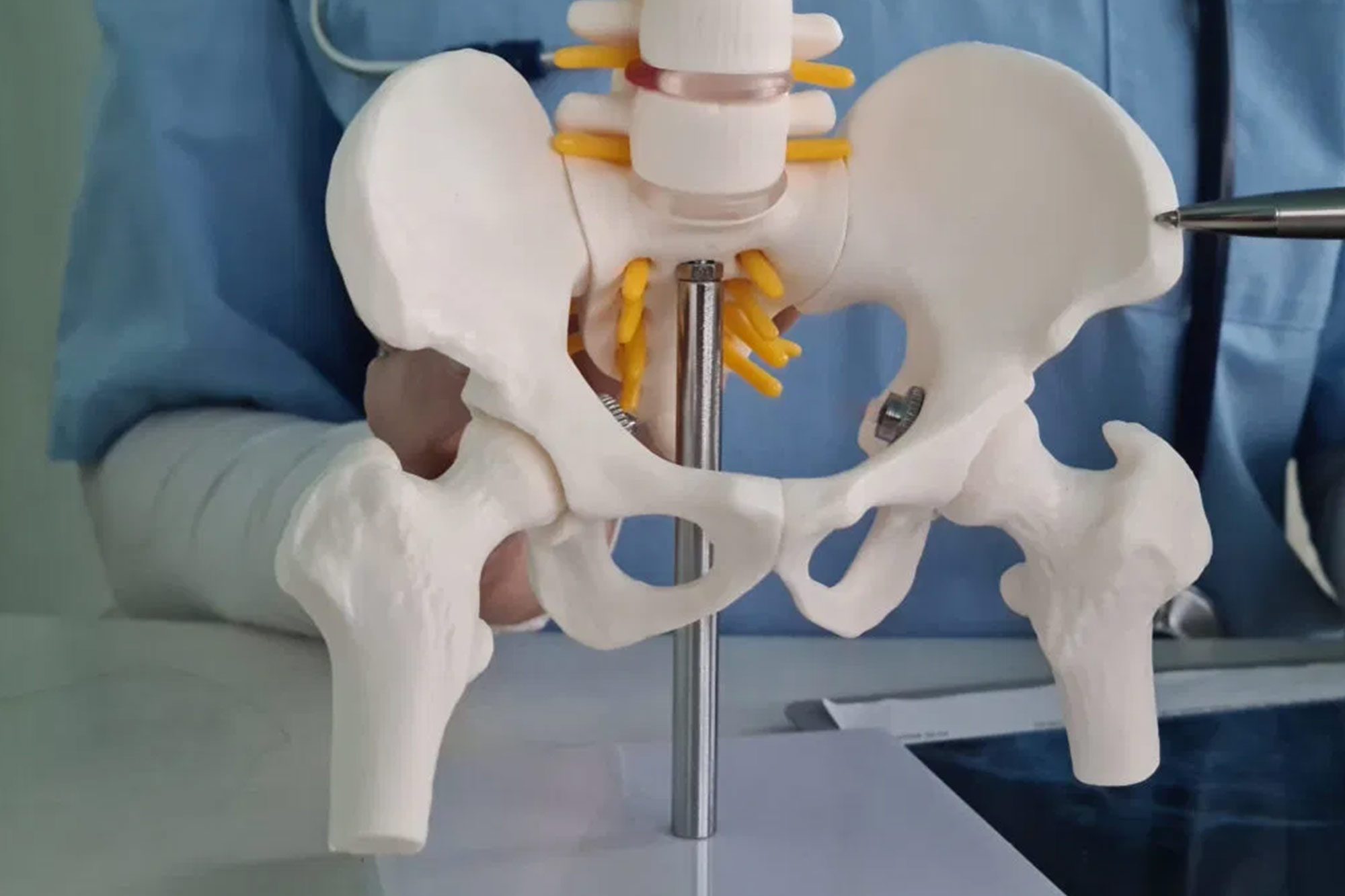 Hip Replacement Surgery Ahmedabad — Bone Plus Hospital
