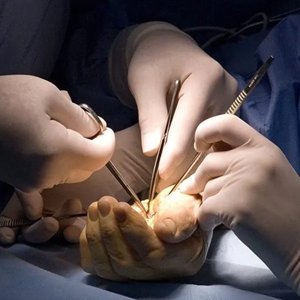 Hand-&-Wrist-Surgery